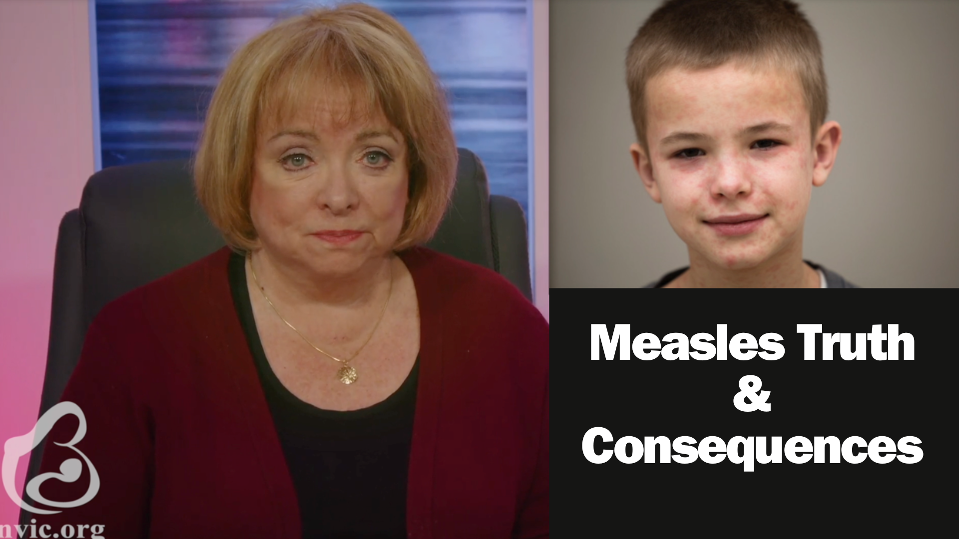 Measles Truth & Consequences