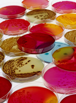 petri dishes