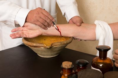 blood letting